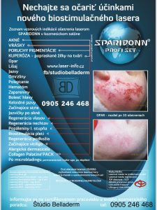 Sparidonn Laser
